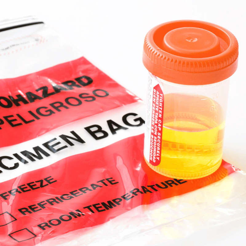 DOT Urine Sample and Specimen Bag Close-up of a DOT urine sample container with an orange lid placed on a red biohazard specimen bag